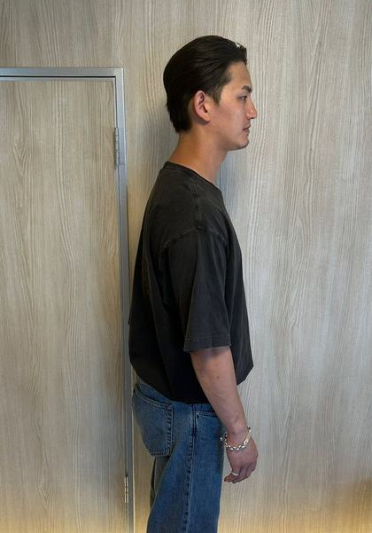 施術前の横から見た立ち姿勢