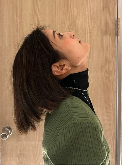 施術前の首を後ろに倒す動き